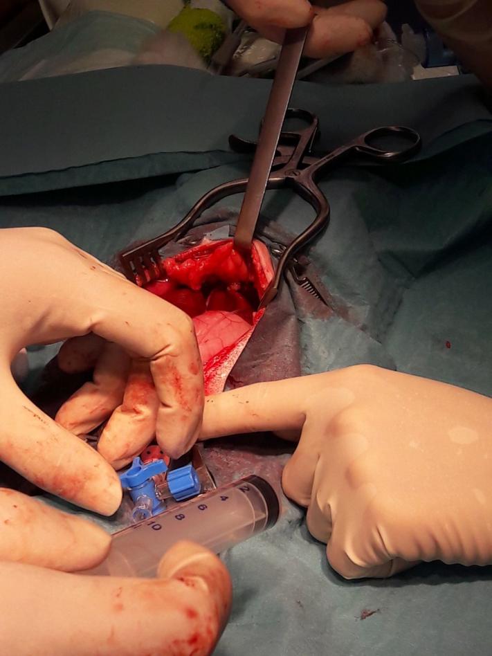 chirurgie